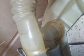 洗衣机排水阀拆卸方法（轻松学会拆卸洗衣机排水阀）