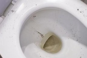 马桶堵了怎么办（应对马桶堵塞问题的有效措施及技巧）