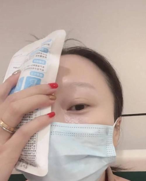 相机蒙镜头纱布的正确使用方法是什么？  第1张
