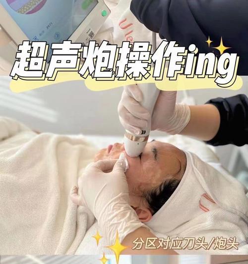 手机摄像头刀头更换步骤？更换后效果如何？  第3张